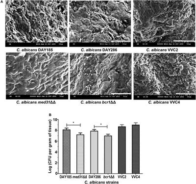 Biofilm Formation of Candida albicans Facilitates Fungal Infiltration and Persister Cell Formation in Vaginal Candidiasis